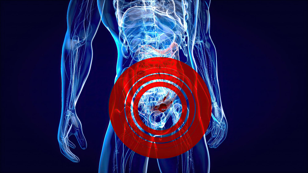 enign prostatic hyperplasia