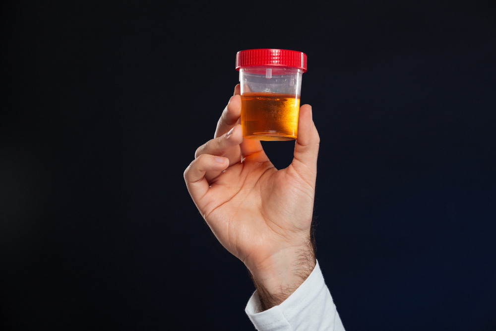Hematuria