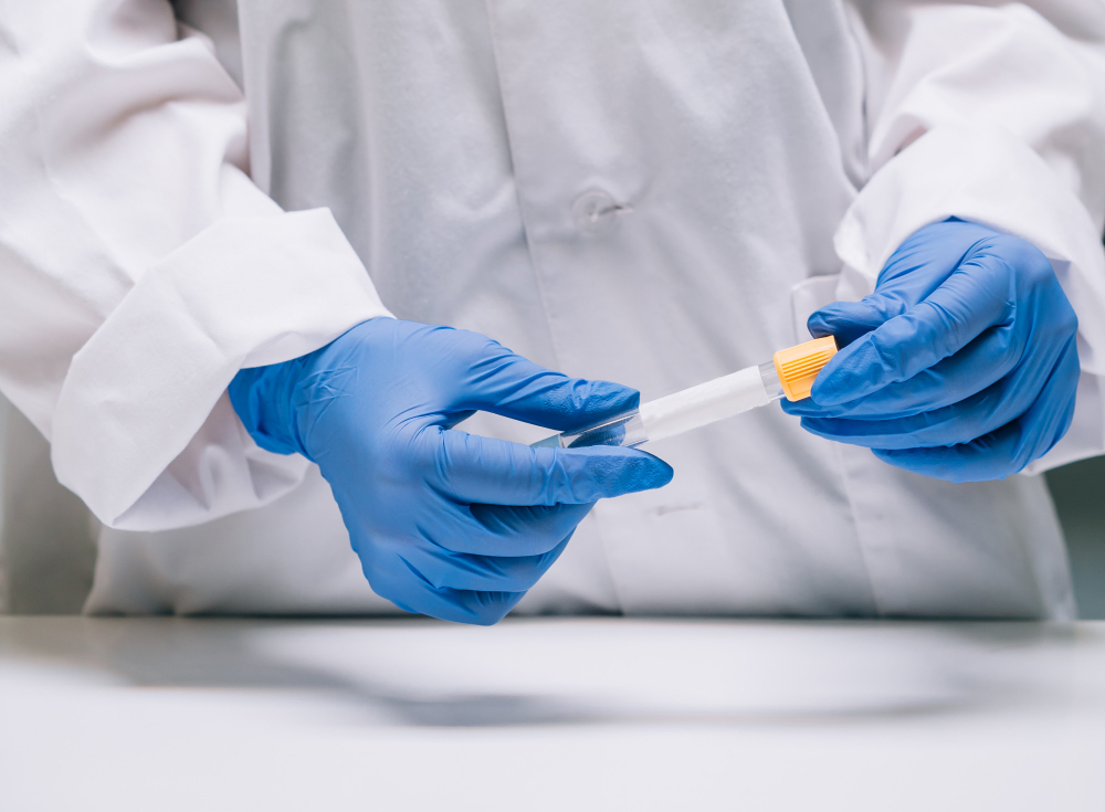 PSA Test