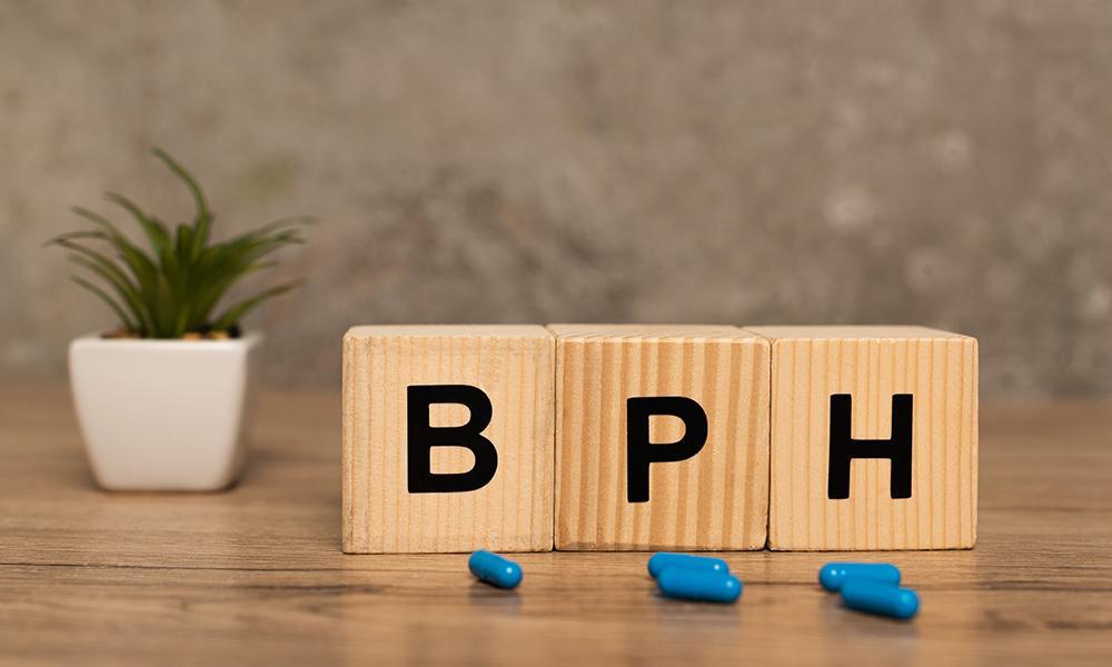 Navigating BPH Therapy