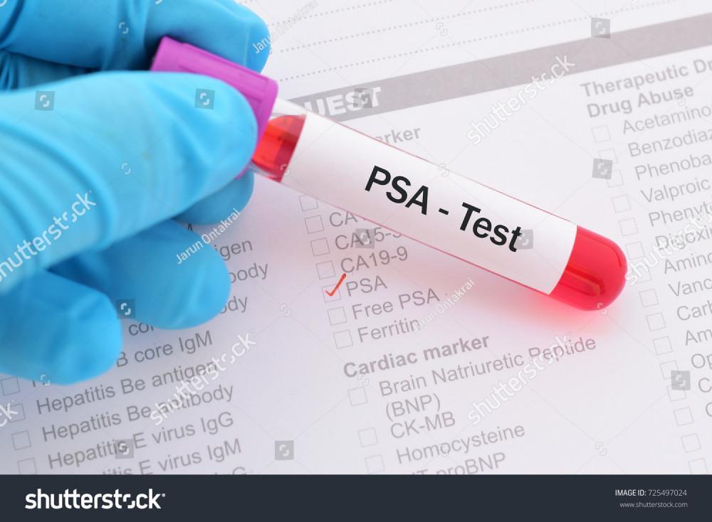 Testing PSA Levels